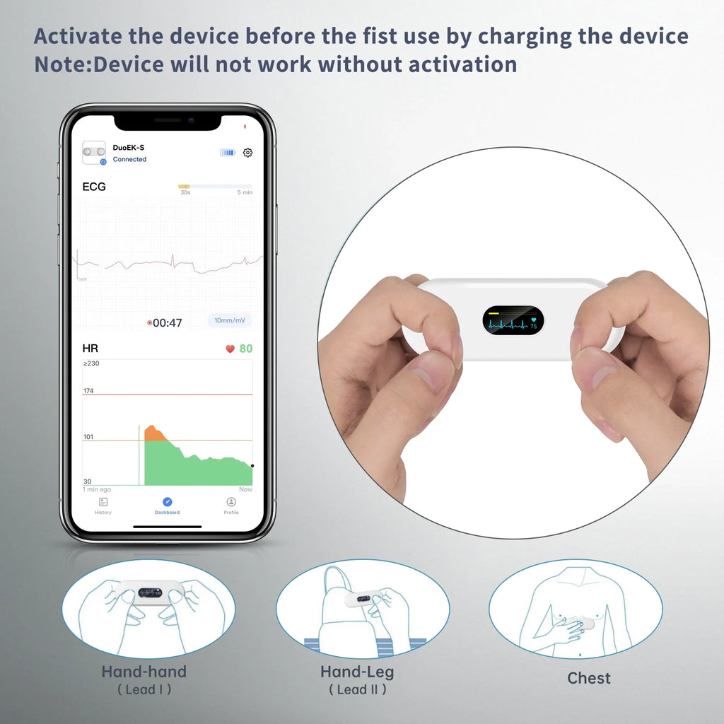 Wellue ECG Heart Monitor with Screen Display,Handheld Bluetooth Personal EKG Monitor with Heart Rate Tracker for Home Use,30s-5mins Measurement,Unlimited Storage Free APP