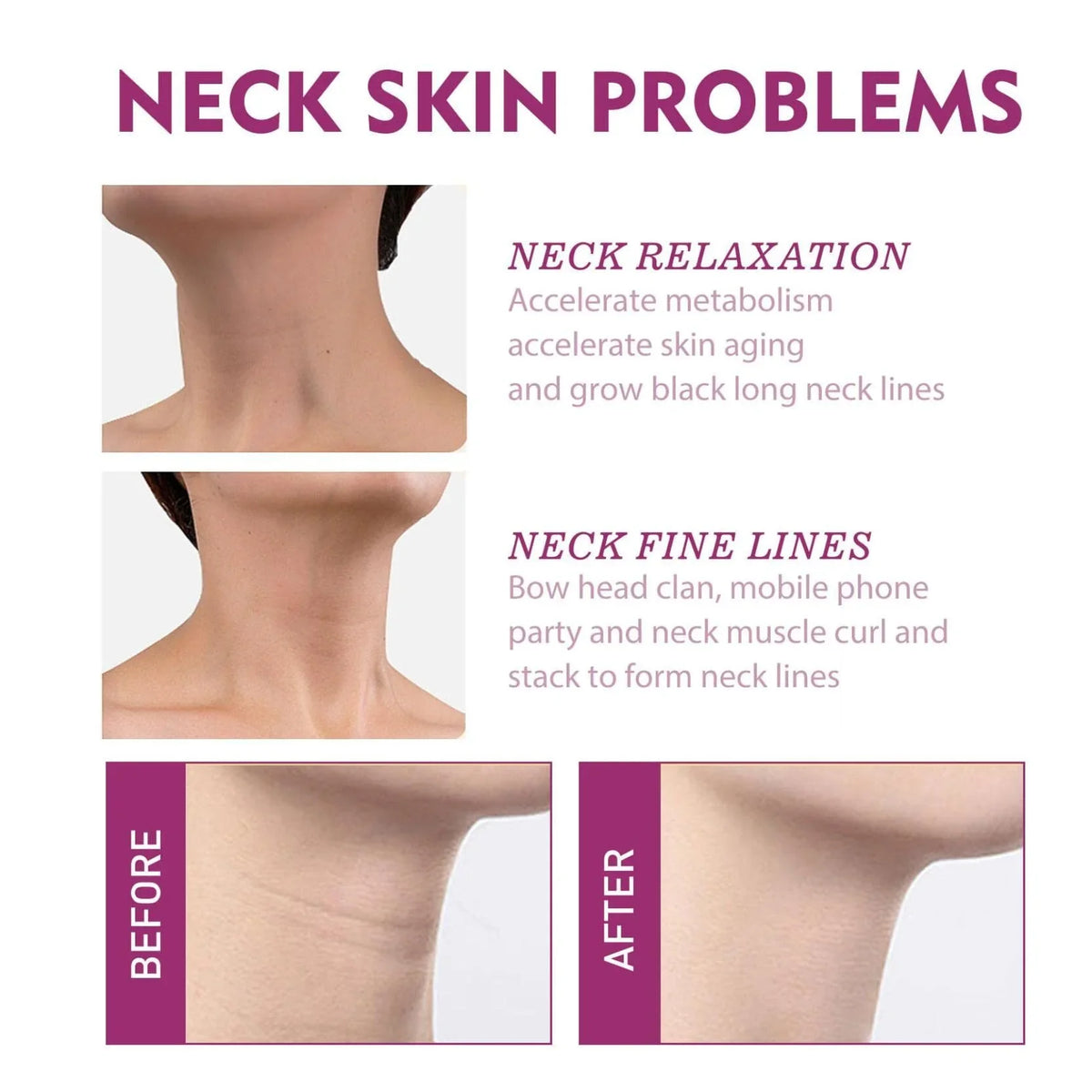 Collagen Neck Cream, Natural Hydrolyzed Collagen For Delay Skin Ageing,Wash-free neck cream, Collagen Neck Firming Cream,Whitens Swan Neck Beauty Neck Cream,7PCS